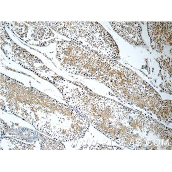FXYD4 Rabbit Polyclonal Antibody (11966-1-AP)