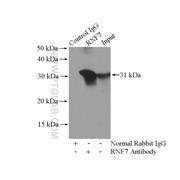 RNF7 Rabbit Polyclonal Antibody (11905-1-AP)