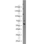 ERO1L Rabbit Polyclonal Antibody (12007-1-AP)