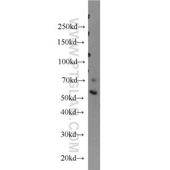 ERO1L Rabbit Polyclonal Antibody (12007-1-AP)
