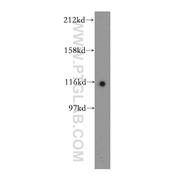 POP1 Rabbit Polyclonal Antibody (12029-1-AP)