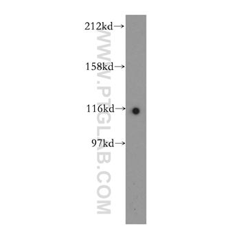 POP1 Rabbit Polyclonal Antibody (12029-1-AP)