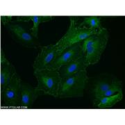 STOM Rabbit Polyclonal Antibody (12046-1-AP)