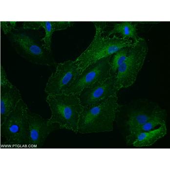 STOM Rabbit Polyclonal Antibody (12046-1-AP)