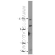 MCPH1 Rabbit Polyclonal Antibody (11962-1-AP)
