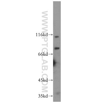 MCPH1 Rabbit Polyclonal Antibody (11962-1-AP)