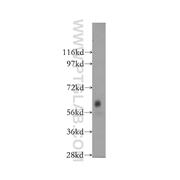 DTNB Rabbit Polyclonal Antibody (12045-1-AP)