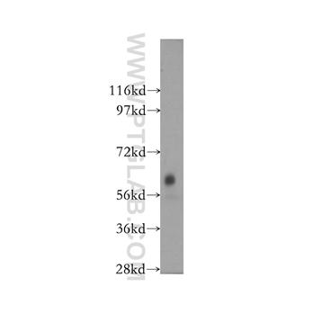 DTNB Rabbit Polyclonal Antibody (12045-1-AP)