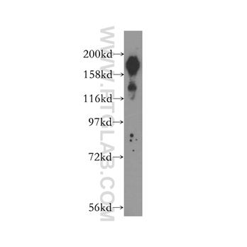 BCOR Rabbit Polyclonal Antibody (12107-1-AP)