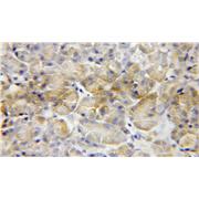 MCCC2 Rabbit Polyclonal Antibody (12117-1-AP)