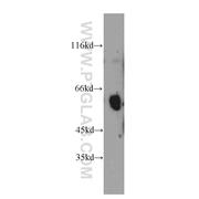 UMOD Rabbit Polyclonal Antibody (11911-1-AP)