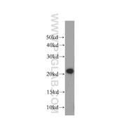 COMMD1 Rabbit Polyclonal Antibody (11938-1-AP)