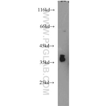CRX Rabbit Polyclonal Antibody (12047-1-AP)