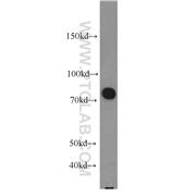 EXOC7 Rabbit Polyclonal Antibody (12014-1-AP)
