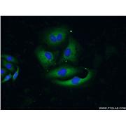 AGR3 Rabbit Polyclonal Antibody (11967-1-AP)
