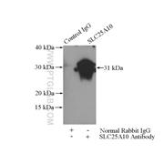SLC25A10 Rabbit Polyclonal Antibody (12086-1-AP)
