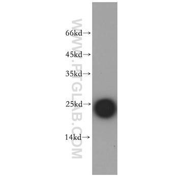 CSHL1 Rabbit Polyclonal Antibody (11883-1-AP)