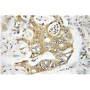EXOC4 Rabbit Polyclonal Antibody (11913-1-AP)