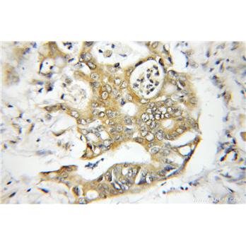 EXOC4 Rabbit Polyclonal Antibody (11913-1-AP)