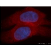 MYCBP Rabbit Polyclonal Antibody (12022-1-AP)