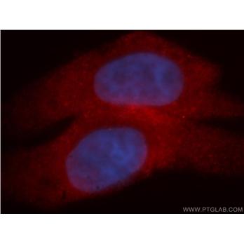 MYCBP Rabbit Polyclonal Antibody (12022-1-AP)