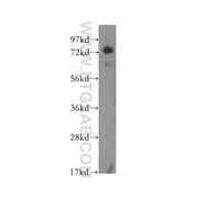 IL17RE Rabbit Polyclonal Antibody (11984-1-AP)