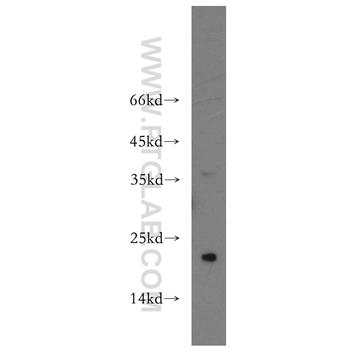 SPANXC Rabbit Polyclonal Antibody (11957-1-AP)