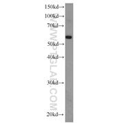 EFEMP2 Rabbit Polyclonal Antibody (12004-1-AP)