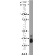 CREM Rabbit Polyclonal Antibody (12131-1-AP)