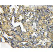 RASSF6 Rabbit Polyclonal Antibody (11921-1-AP)