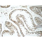 EXOSC8 Rabbit Polyclonal Antibody (11979-1-AP)