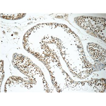 EXOSC8 Rabbit Polyclonal Antibody (11979-1-AP)