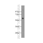 STK3 Rabbit Polyclonal Antibody (12097-1-AP)