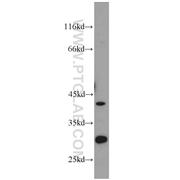 IL1RL1 Rabbit Polyclonal Antibody (11920-1-AP)