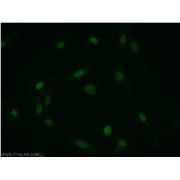 PTMS Rabbit Polyclonal Antibody (12106-1-AP)
