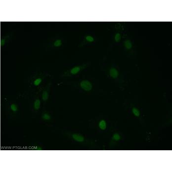 PTMS Rabbit Polyclonal Antibody (12106-1-AP)