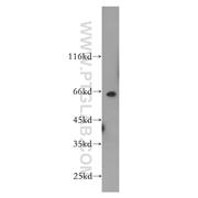 PRCC Rabbit Polyclonal Antibody (12019-1-AP)