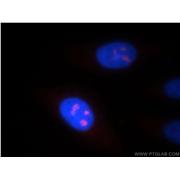 NOL8 Rabbit Polyclonal Antibody (12043-1-AP)