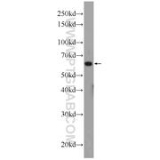 PHF19 Rabbit Polyclonal Antibody (11895-1-AP)