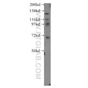 NTRK3 Rabbit Polyclonal Antibody (11999-1-AP)