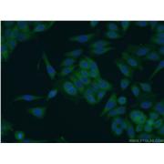 SCHIP1 Rabbit Polyclonal Antibody (11939-1-AP)