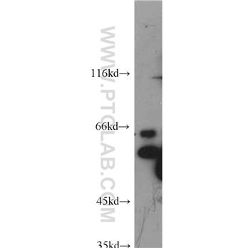 ATF2 Rabbit Polyclonal Antibody (11908-1-AP)