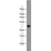 GOSR2 Rabbit Polyclonal Antibody (12095-1-AP)