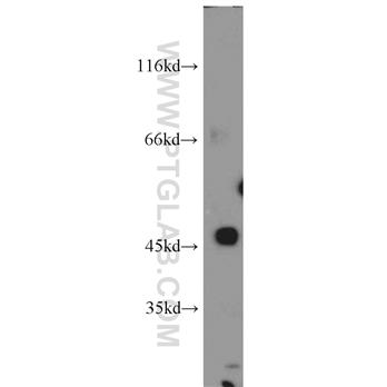 TMEFF2 Rabbit Polyclonal Antibody (11928-1-AP)