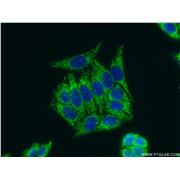 ATPIF1 Rabbit Polyclonal Antibody (12067-1-AP)