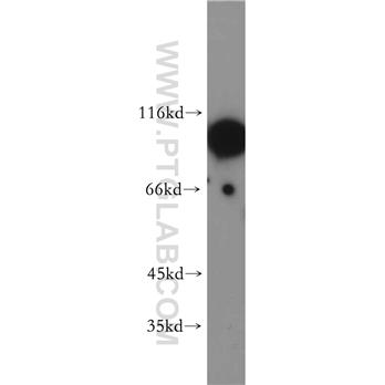 DLGAP5 Rabbit Polyclonal Antibody (12038-1-AP)
