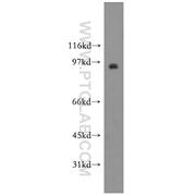 SYT11 Rabbit Polyclonal Antibody (12031-1-AP)