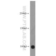 HELLS Rabbit Polyclonal Antibody (11955-1-AP)