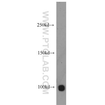 HELLS Rabbit Polyclonal Antibody (11955-1-AP)