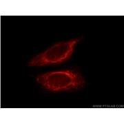WSB2 Rabbit Polyclonal Antibody (12124-2-AP)